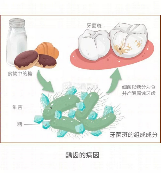 (图源:腾讯医典)