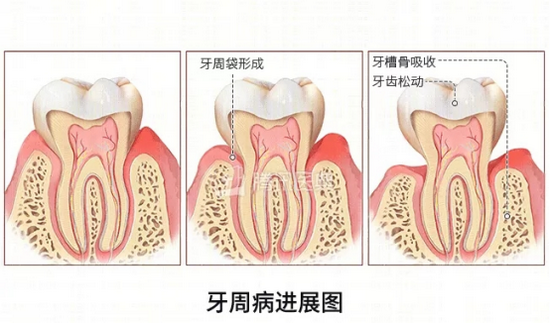 (图源:腾讯医典)