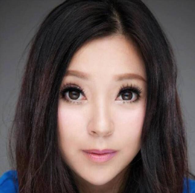 整容塌脸崩坏女星集锦！啊，抬头看，苍天饶过谁！