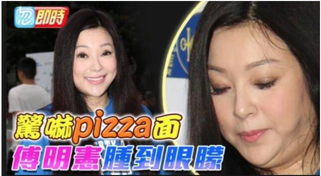 整容塌脸崩坏女星集锦！啊，抬头看，苍天饶过谁！