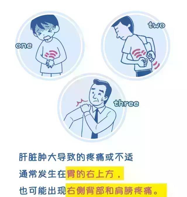 健康漫画 腹痛何时是乙肝相关疼痛 何时是其他疼痛