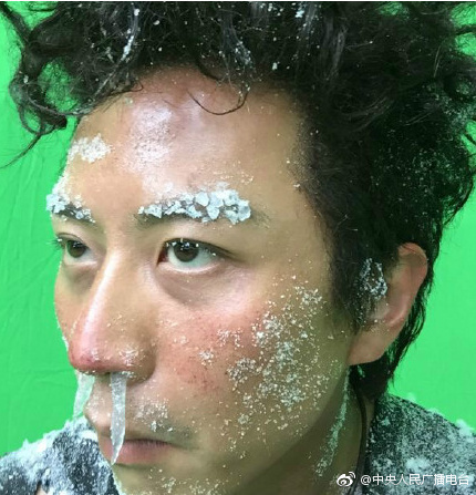 小伙发现自己鼻涕很甜,医生说是脑子里的 水 !