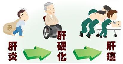 乙肝患者以后看病不再自掏腰包!