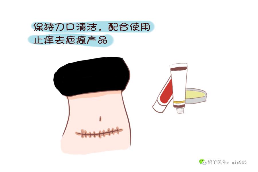 仍想要结婚的女人