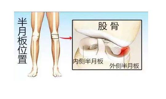 为什么会关节响 add7-fyecrxv3953979.jpg