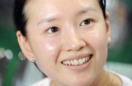 又一个baby？整了牙之后的胡杏儿美得不敢认
