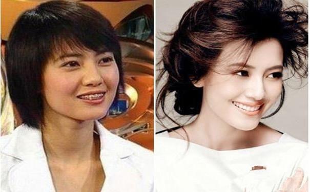 又一个baby？整了牙之后的胡杏儿美得不敢认