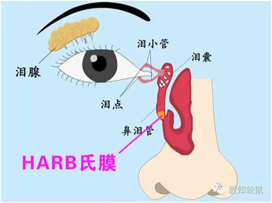 粘土长宝宝,流眼屎,眼泪眼,斗鸡眼.都是病?舞龙舞狮轻大小图片