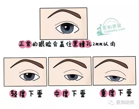 宝宝长眼屎、流眼泪、大小眼、斗鸡眼.都是病