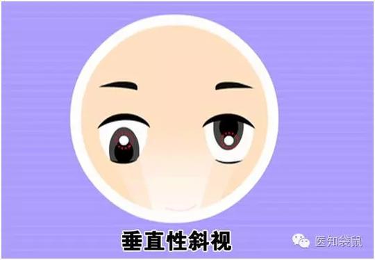 宝宝长眼屎、流眼泪、大小眼、斗鸡眼.都是病