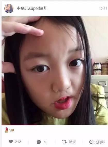 李嫣在娘胎里才四个月就被诊断是兔唇,王菲:这不是个事!
