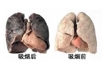 戒烟成功之后,身体有5个神奇的变化