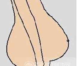 孕妈都知道尖肚、圆肚,可是都不知道 悬垂肚 ?