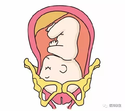 5大征兆告诉你:胎儿入盆是什么感觉?