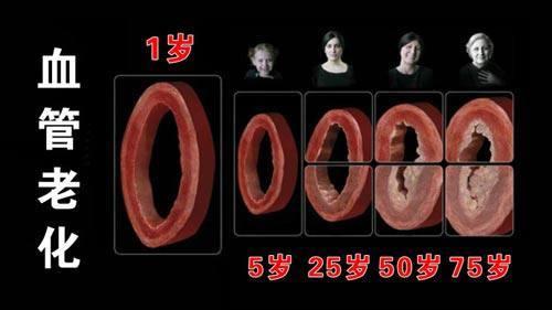 医生告诫：4个征兆说明你的血管堵塞，血液粘稠如粥