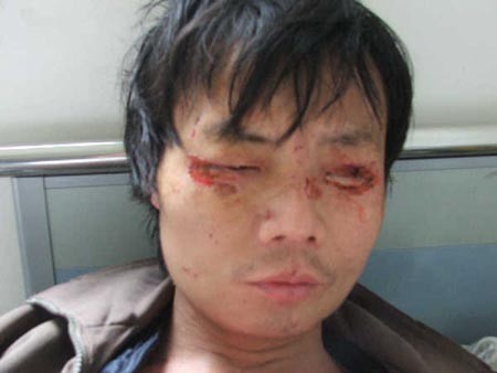壮男被娇妻锁家中长期虐待[组图]