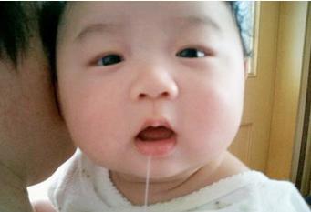 宝宝流口水妈妈没在意 去医院检查却让妈妈晴天霹雳
