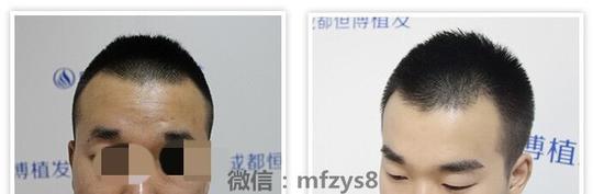 明星尴尬之最——素颜看不到眉毛