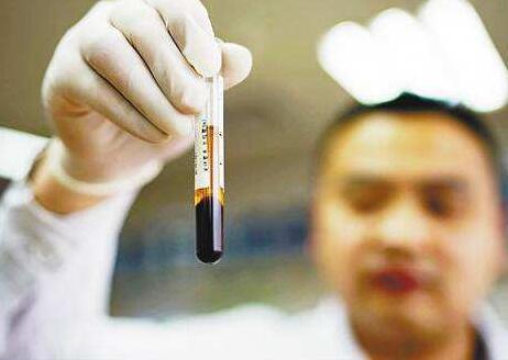 5岁小女孩连续咳嗽三四个月, 这味药解决根本