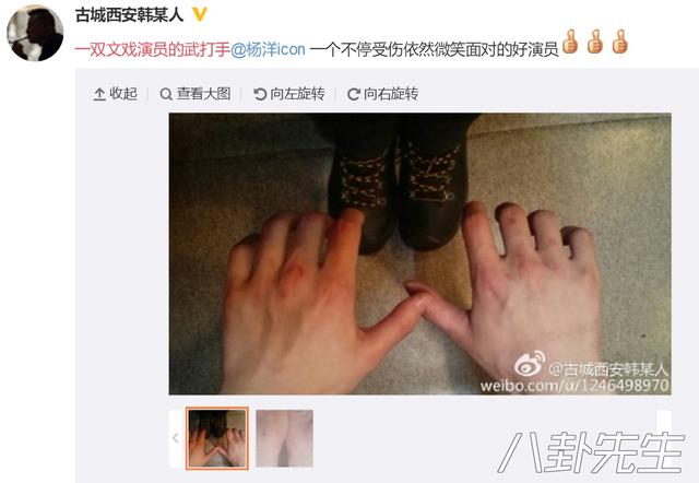跟内地小鲜肉相比，TVB的演员真是太傻了