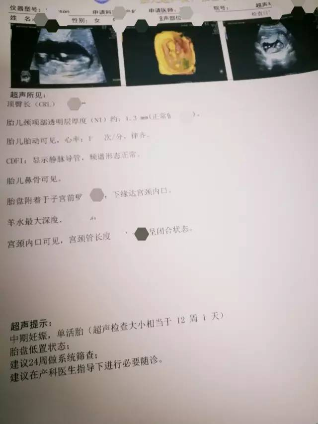 【专家告诉你】什么是NT检查:孕妈咪一定要懂