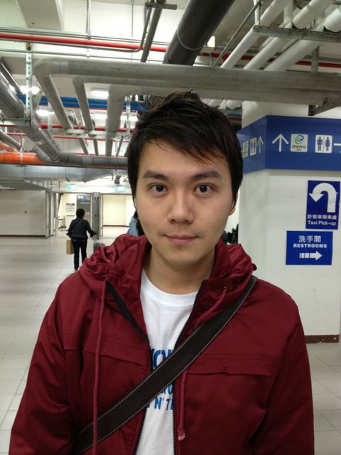 男士割双眼皮手术后变身大眼型男