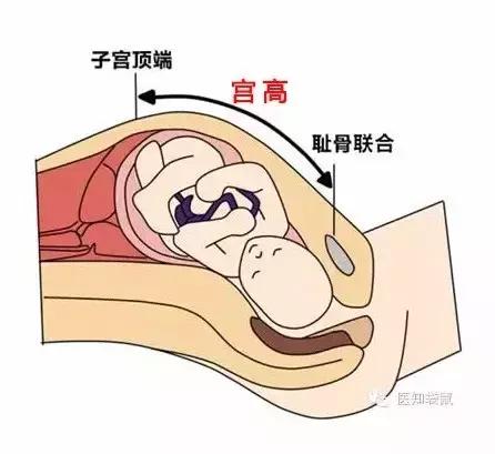 医生是怎么算胎儿体重的?宝宝出生时几斤最合