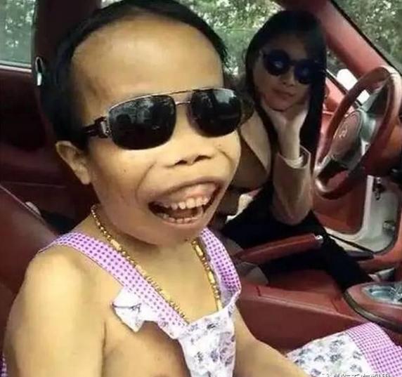 靠被骂出名的网红陈山,因病外表丑,现在已拥有