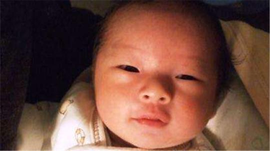 宝宝出疹子时,需要和哪些疾病鉴别?