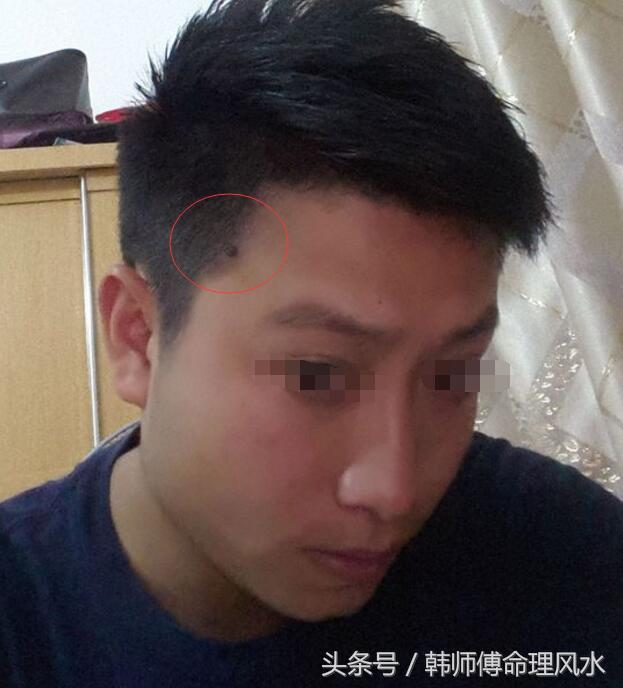 头发中有痣,一生不愁吃穿.