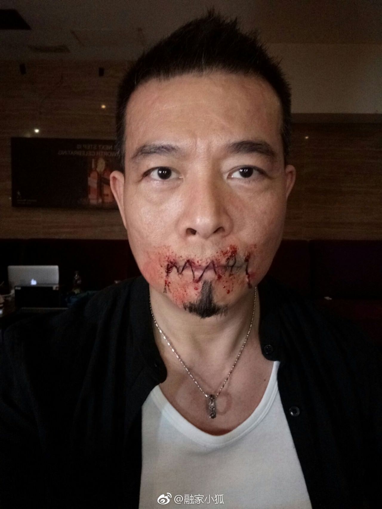 【反黑】招積復出報復火屎酷刑縫嘴　吳毅將：冇機會爆佢響口！