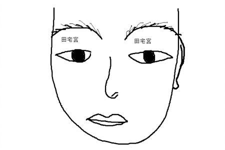 田宅宫痣