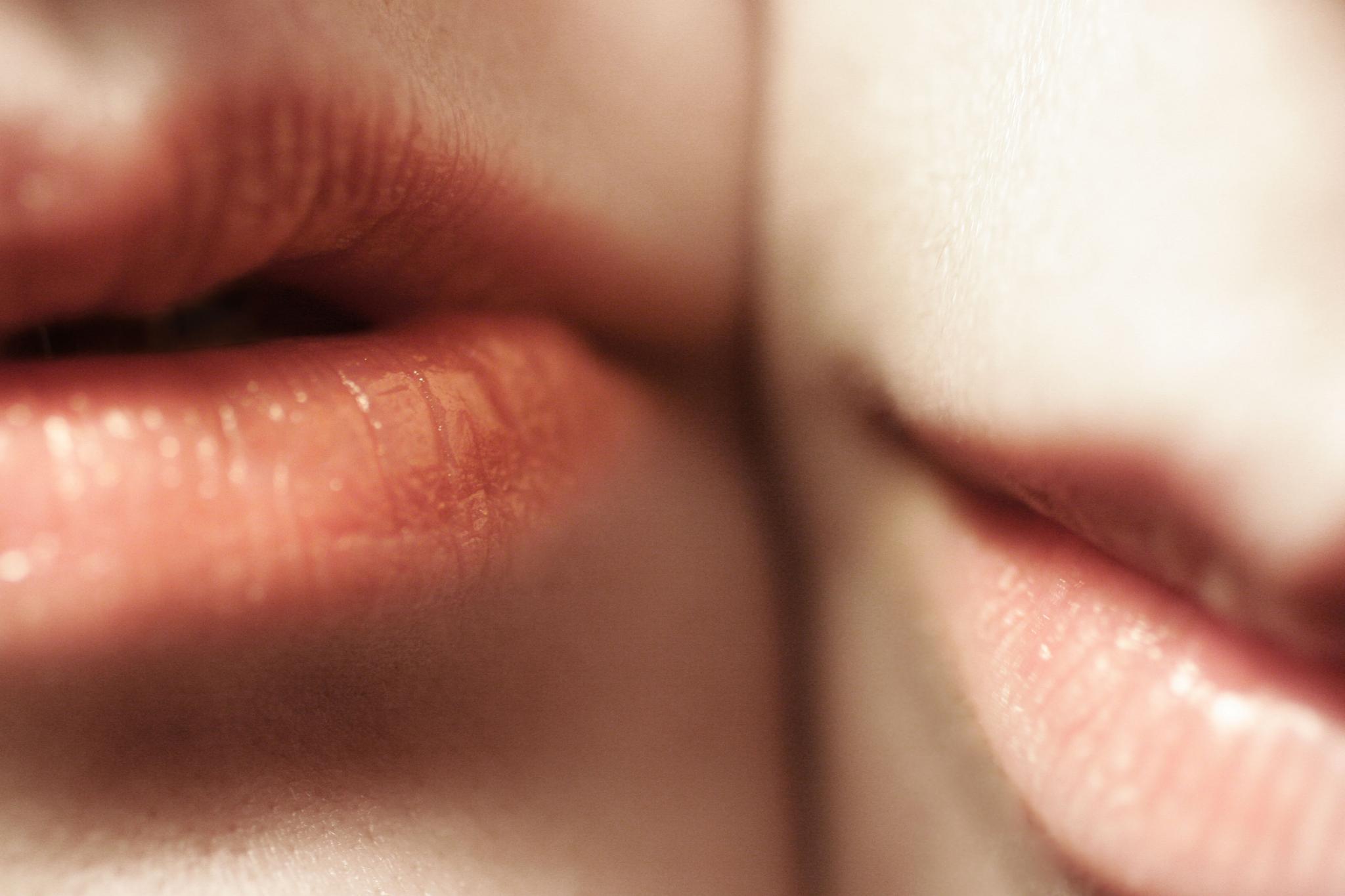 Chapped Lips: Rescue Your Pout | Averr Aglow®