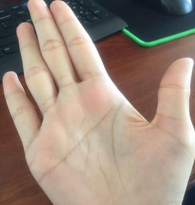 手上出现双重生命线,是福气之人,是长寿之人!