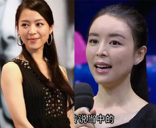 漂亮女神张静初整容了吗 张静初整容前后照片对比