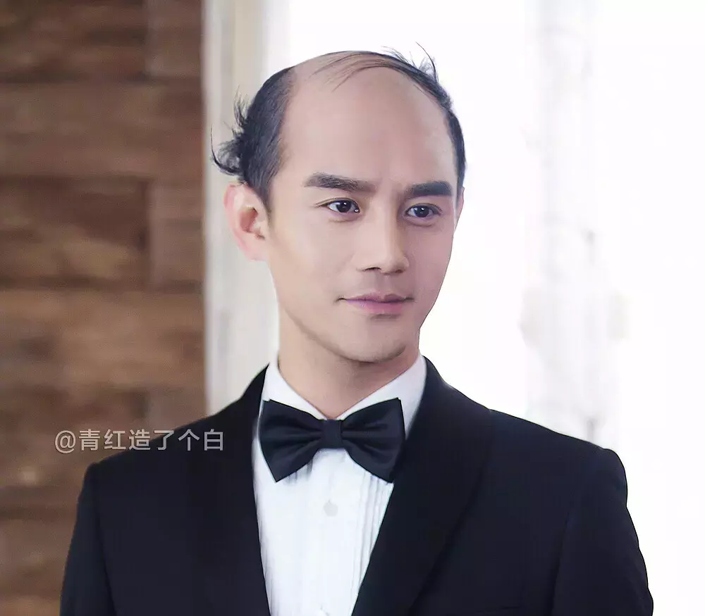 “我变秃了,也变强了”有科学根据吗?如何面对秃如其...