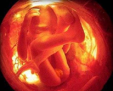 14岁男孩胸部变大下体流血,去医院检查后,父母