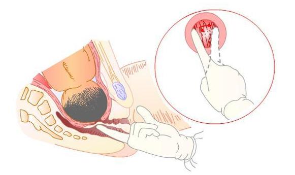 过来人：孕妇最害怕男医生“一阳指”肛检和内检很疼？男医生扣私处尴尬