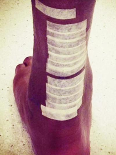 血腥! 科比跟腱断裂有多痛, 手术过程告诉你!