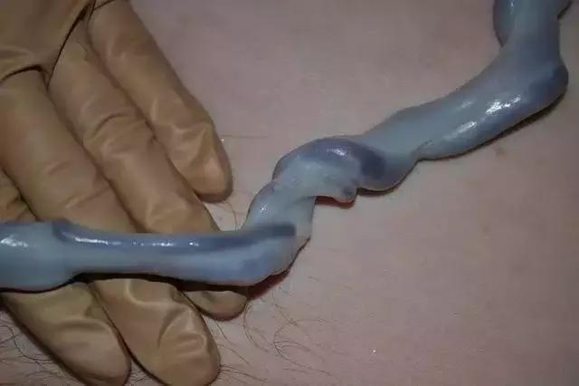 宝宝出生剪脐带早晚有讲究,剪错影响宝宝一生!图片