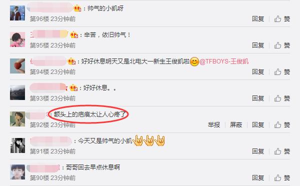 王俊凯帅气现身机场,但却被额头上的疤痕抢镜