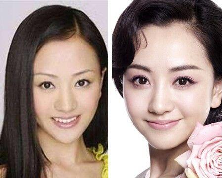 于朦胧有整容吗