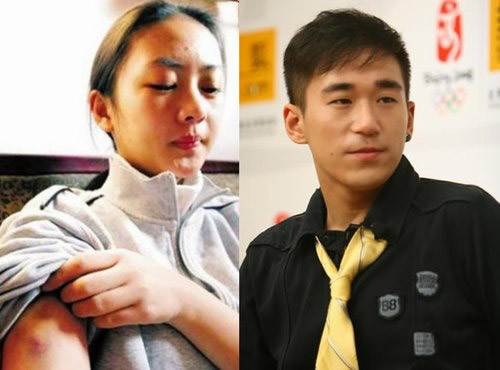 张默为什么要打童谣？七年之后终于公开了真相