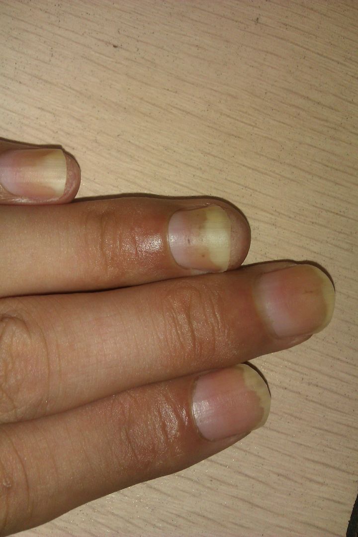 听说大黄片能治便秘在网上乛买了吃了5粒怎么没有效果?