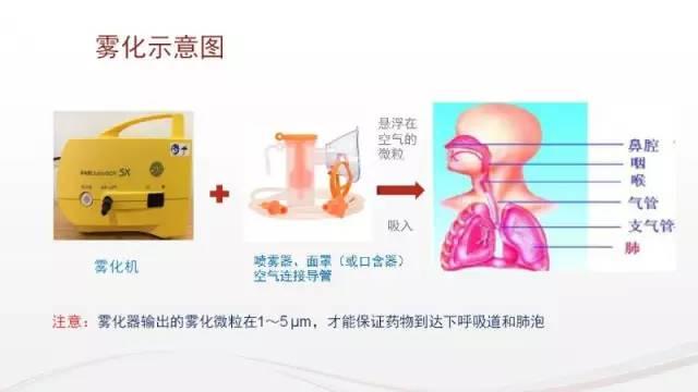 孩子咳嗽要雾化吗?看完这篇你就有底了!