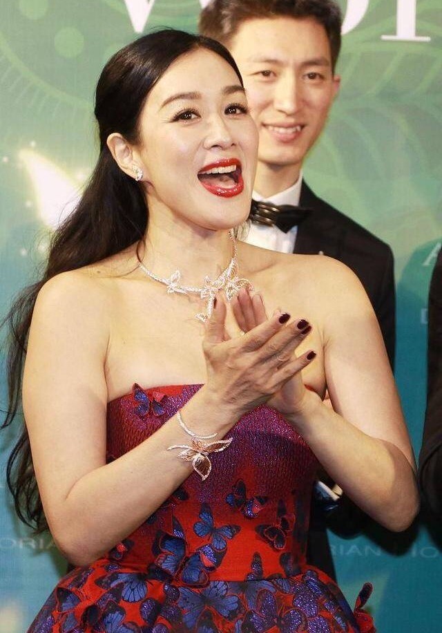 "不老女神"钟丽缇这次尴尬了,手臂的现状将实际年龄