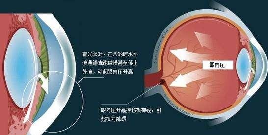 眼部疾病有哪些