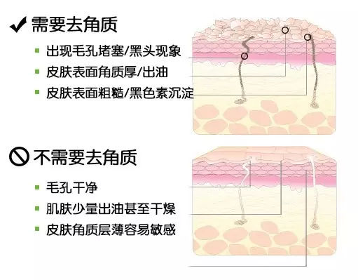 辨别什么是肌肤屏障受损,怎么样才能让皮肤恢