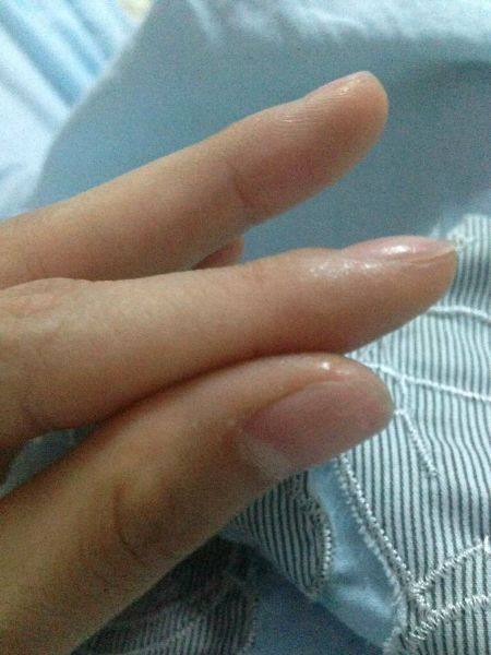 如果手指不小心被502胶水黏住,别急,教你几招轻松解决
