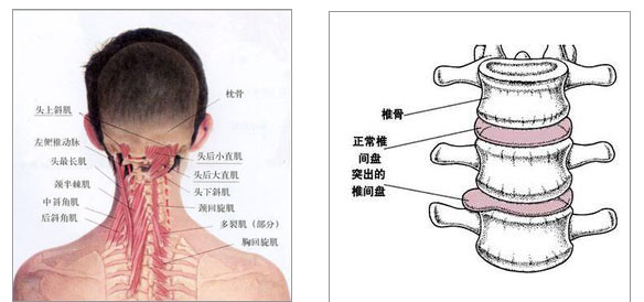 几种颈椎病的治疗偏方，竟如此神奇？
